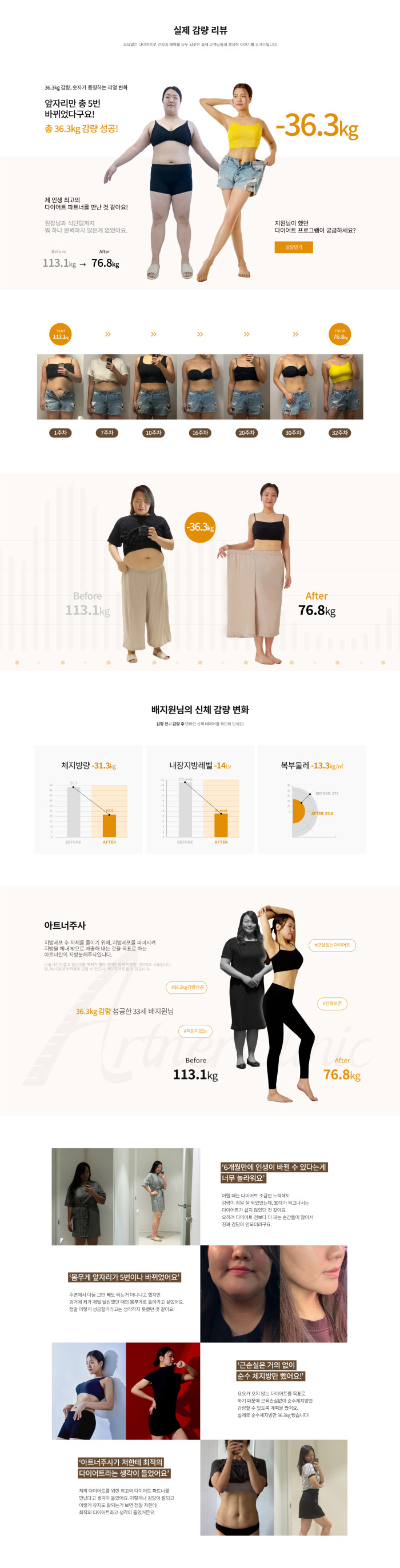 아트너주사 -36.3kg 성공스토리
