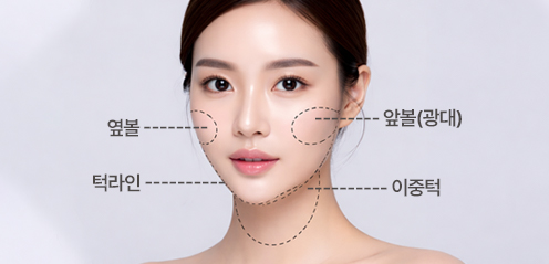 페이스 아트너 주사 적용 부위